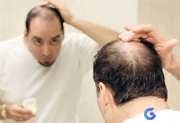 Giải mã giấc mơ rụng tóc cùng con số phát tài